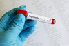 iStock-Legionella-486818448.jpg